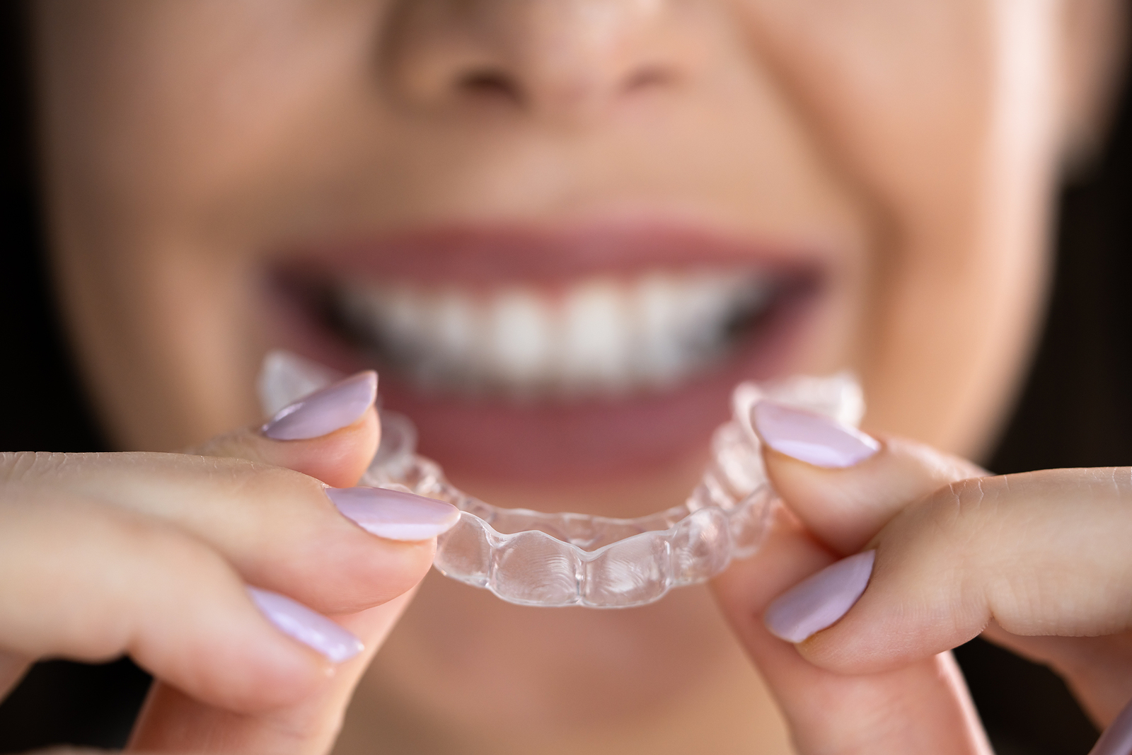 Clear Aligners Clear Aligners