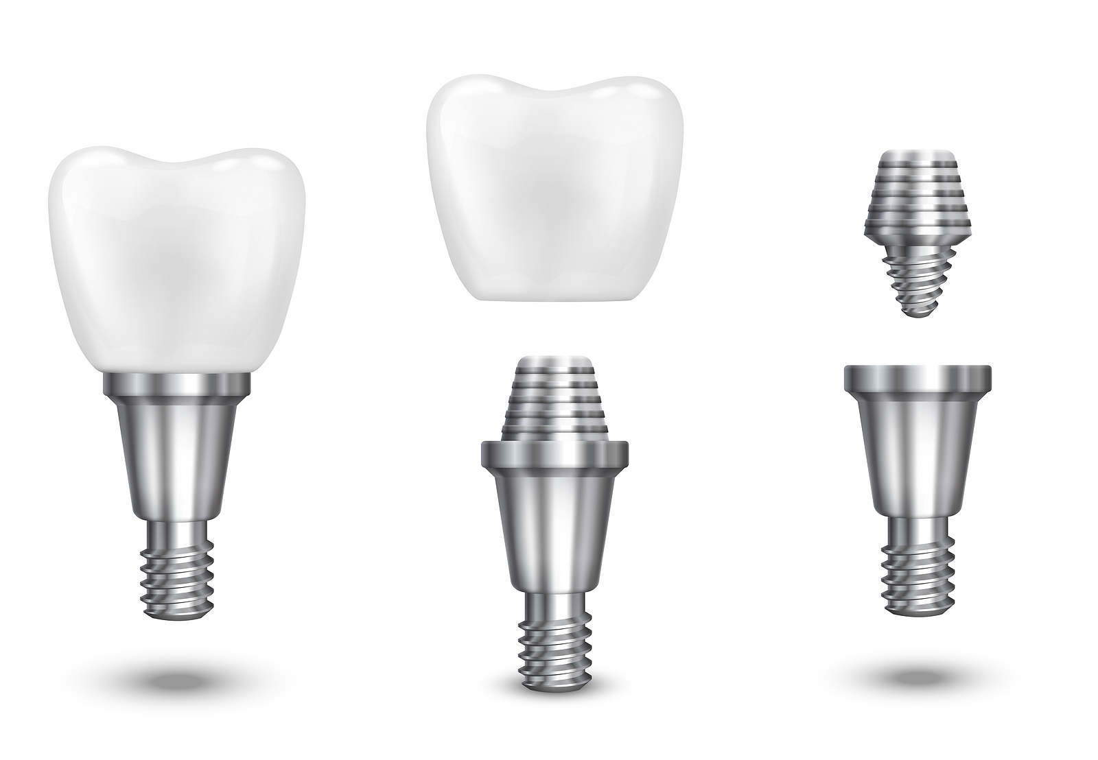 Tooth implant Tooth implant