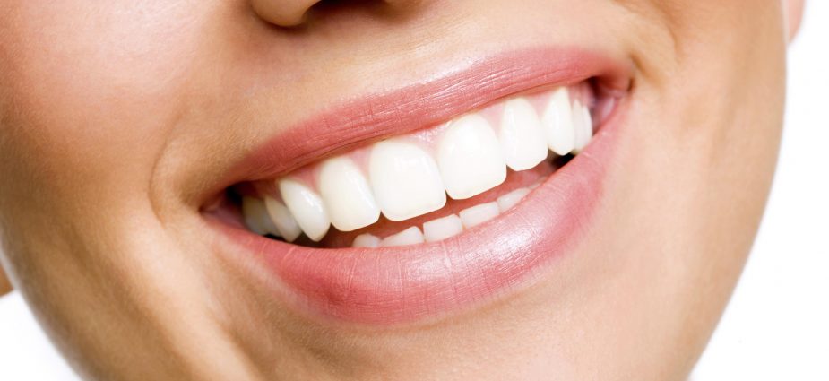 Teeth Whitening Teeth Whitening