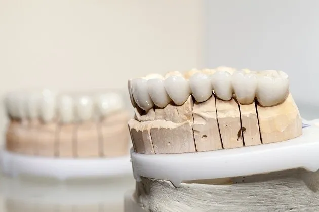 Veneers Veneers